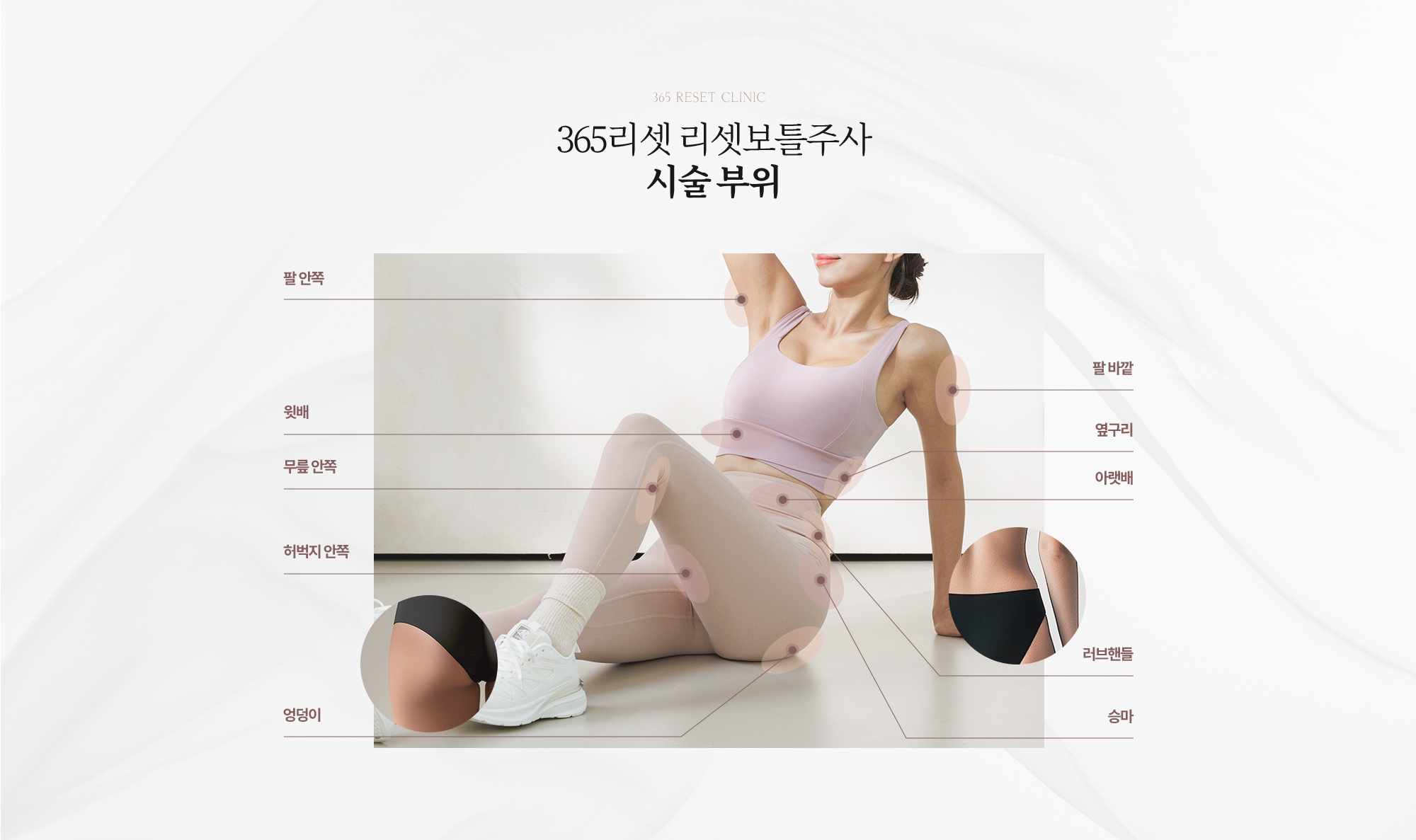 시술부위