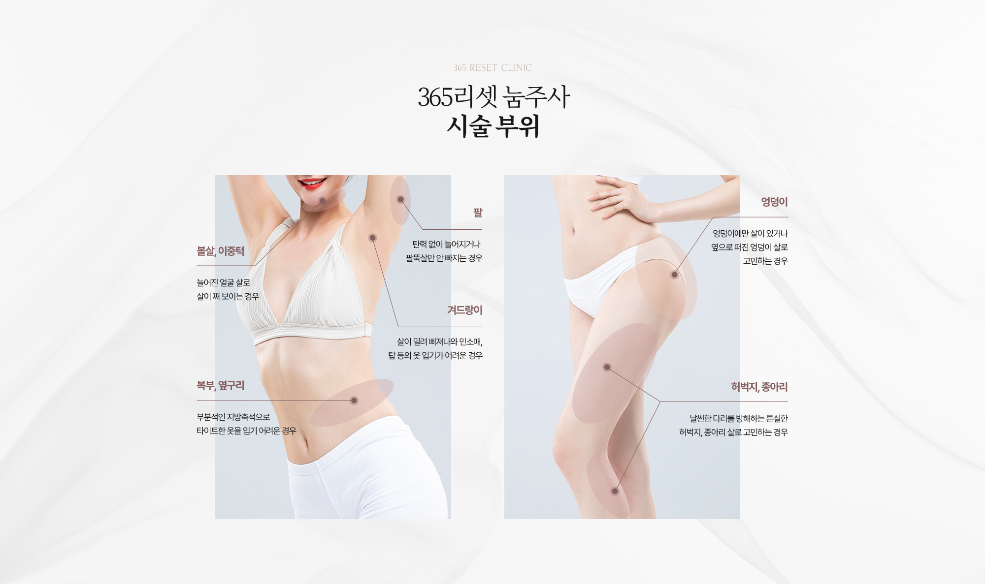 시술부위