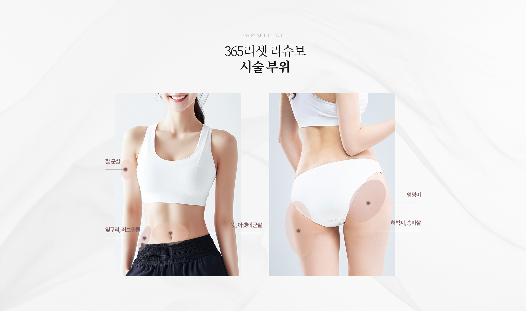 시술부위