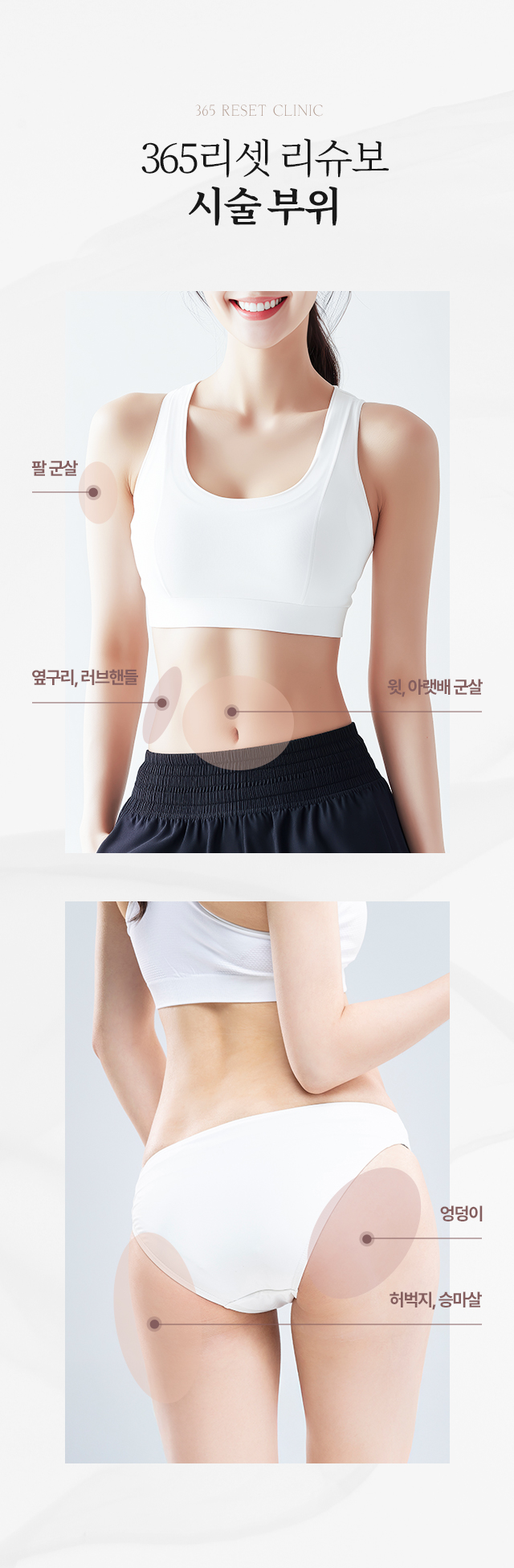 시술부위